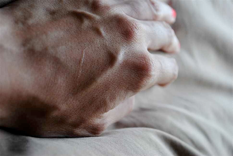 Illustration for article titled 3 Photos Of Blood (It's OK, They're Fake)